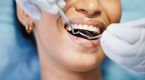 Best After-Hours Dental Care in Garnet, CA