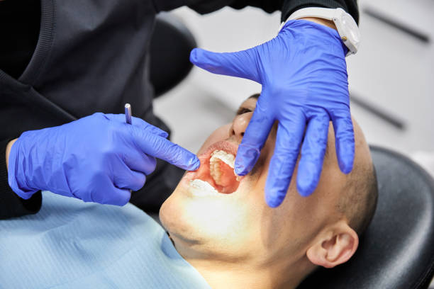 Best Walk-In Emergency Dental Services in Garnet, CA